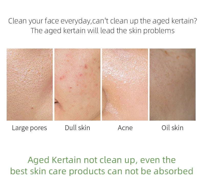 LAIKOU Matcha Exfoliating Exfoliate Peeling Gel Facial Scrub Moisturise  Nourishing Repair Scrubs Face Cream Skin Care